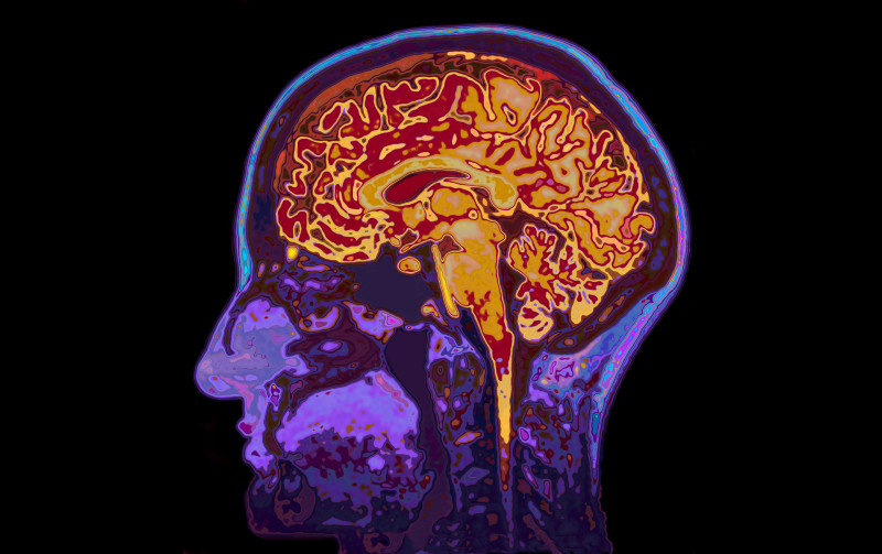 Dizzy Spells No More! Learn About the Most Successful Treatment for Vertigo in New Jersey