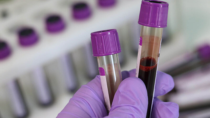 Understanding the PHMSA Drug Test Panel: What You Need to Know