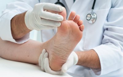 Improve Mobility and Comfort with Expert Diabetic Foot Care in Jacksonville, FL