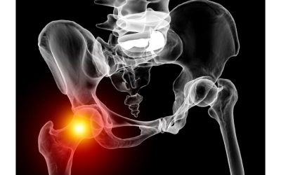 The benefits of advanced techniques for bone fracture repair in Louisville, KY patients