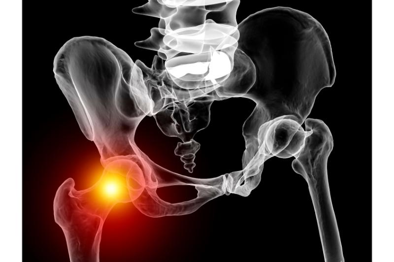 The benefits of advanced techniques for bone fracture repair in Louisville, KY patients